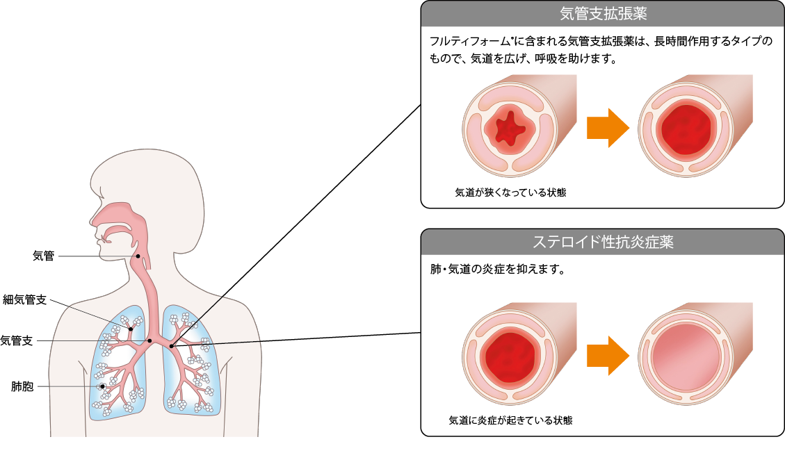 フルティフォーム®は、どのようにして効くのですか？